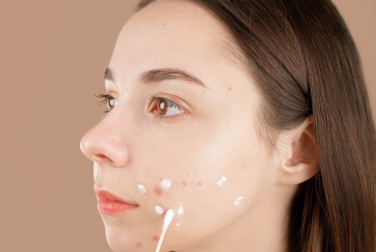 Inestetismi della pelle: tipologie e cause delle imperfezioni cutanee