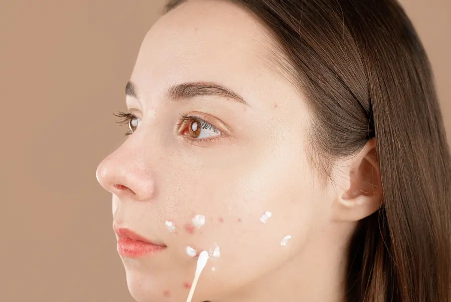 Inestetismi della pelle: tipologie e cause delle imperfezioni cutanee